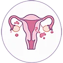 Female infertility treatment with advanced fertility solutions in India