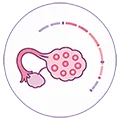 Ovarian follicle development monitoring during fertility treatment in Mumbai