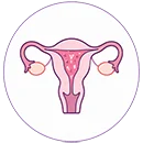 Uterine fertility treatment and reproductive care at Wonder IVF Mumbai