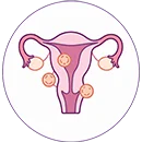 Uterus and reproductive health care services at Wonder IVF Mumbai